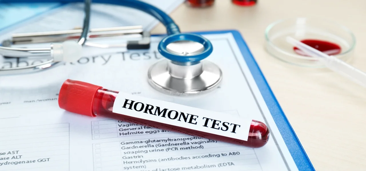 Hormonal Therapy Treatment