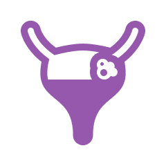 Gynecological Cancers