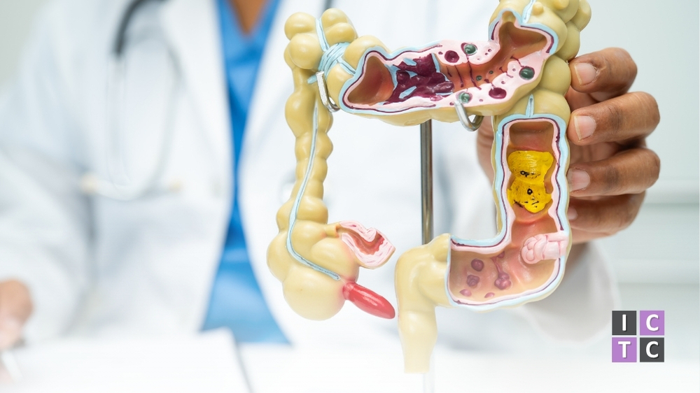 Appendix Cancer & Its Connection to Other GI Cancers